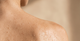 The skin you show the most is the skin you care for the least: a guide to summer body care
