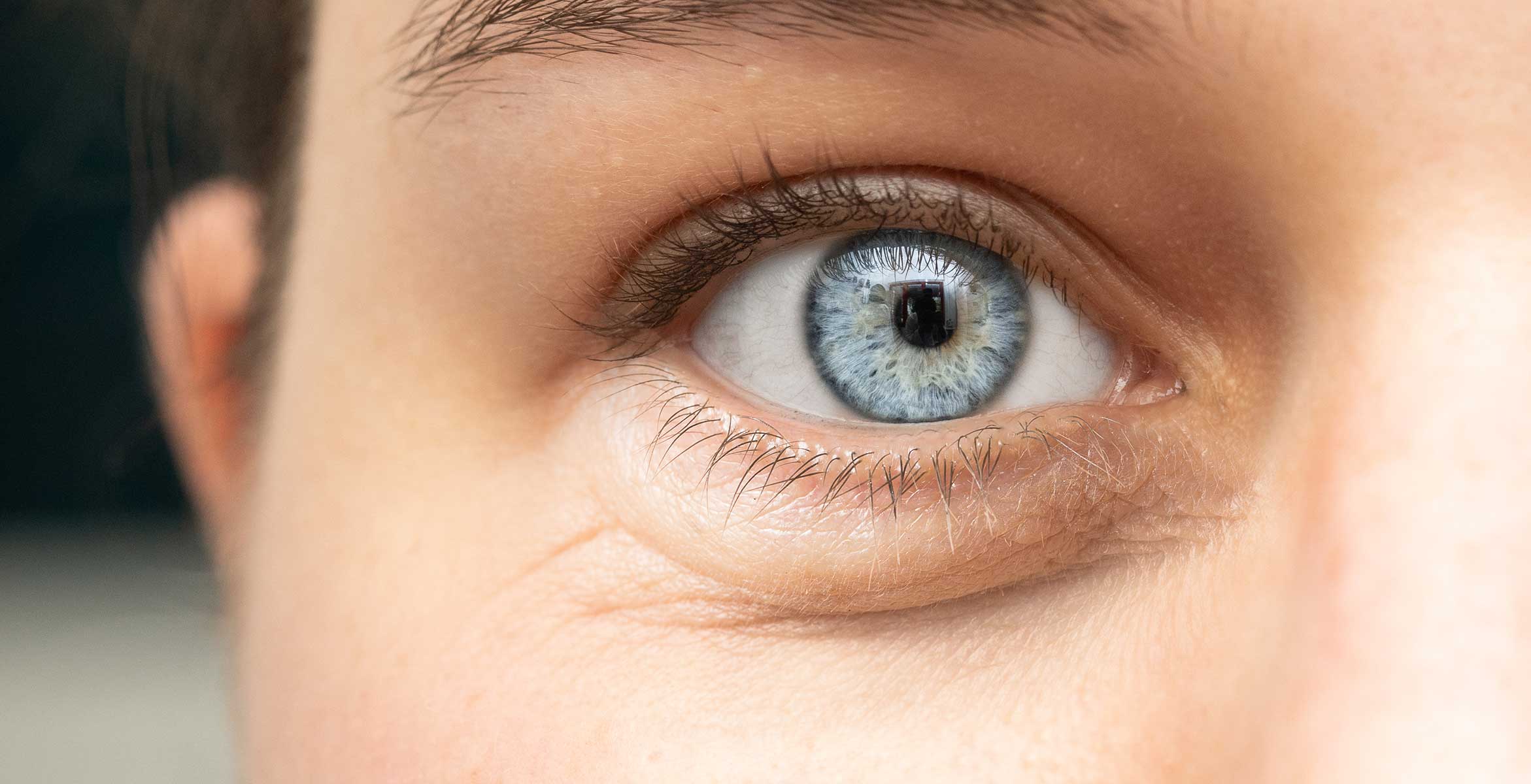 reducir las ojeras con activos naturales