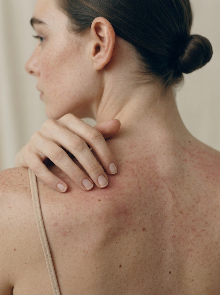 Skin Consultation